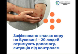 У Чернівецькій області спалах кору — захворіло 29 осіб, Усі хворі госпіталізовані та отримують необхідну медичну допомогу