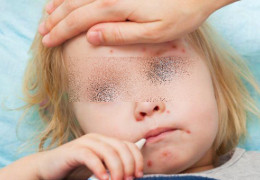 У Чернівцях епідемія кору та ГРВІ. У лікарні померла 10-річна дівчинка, яка не була вакцинованою. Школи області переходять на "дистанційку"
